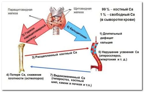 як правильно лікувати остеопороз