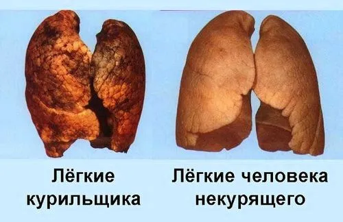 вилікувати легкі після куріння
