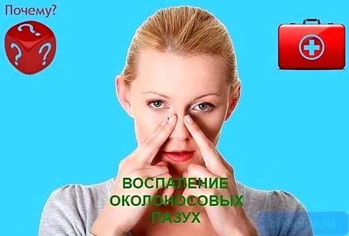 синуси
