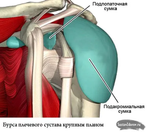 Бурсит: що це, причини, симптоми, діагностика та лікування як лікувати гострий бурсит