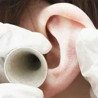 використовуємо перекис при отиті
