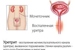 стоп ЗПСШ