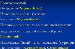 стоп ЗПСШ