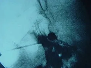 як лікувати нерви особи