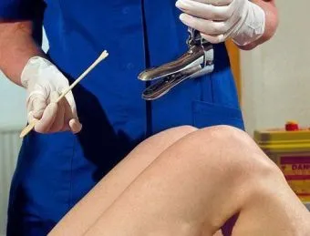 як лікувати вірус папіломи 33