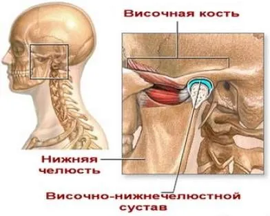як лікувати розтягнення щелепи