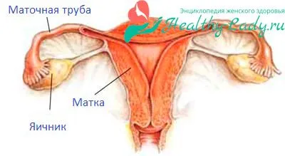 Вузлова форма аденоміозу матки - причини, симптоми, лікування вузловий аденоміоз