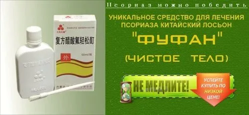 лікувати псоріаз содою