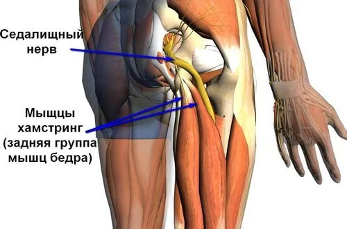 як лікувати розтягнення м'яза стегна