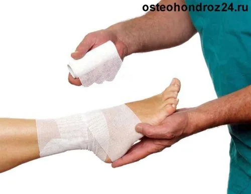 лікування розтягнення зв'язок гомілкостопу суглоба перша допомога