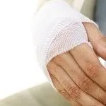 як лікувати розтягнення лучезапястного суглоба