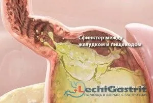 Домашнє лікування печії при підвищеній кислотності як лікувати підвищену кислотність шлунка народними засобами