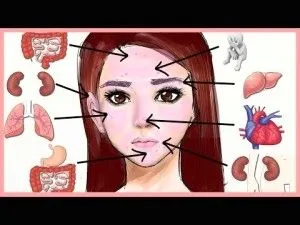 Як лікувати прищі акне як позбавитися від прищів