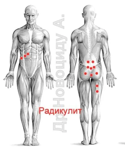 лікувати печінку п'явками