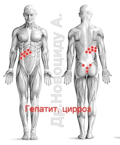 лікувати печінку п'явками