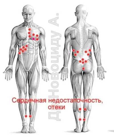 лікувати печінку п'явками