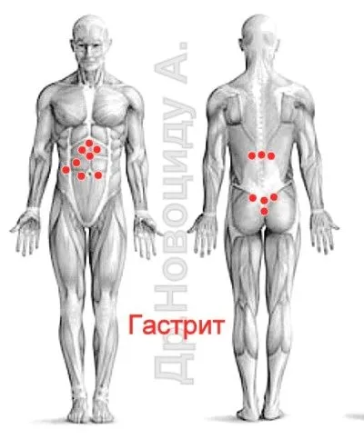 лікувати печінку п'явками
