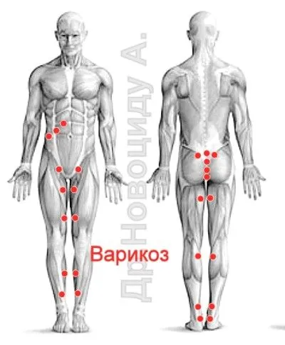 лікувати печінку п'явками