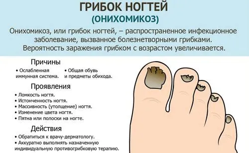 як вилікувати нігті вдома