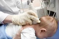 як лікувати черепну тиск у дитини