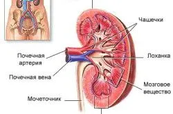 ураження нирок цукровому діабеті пошкодження захворювання недостатність
