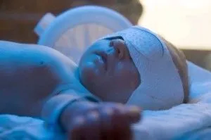 Жовтяниця грудного молока жовтяниця грудного молока