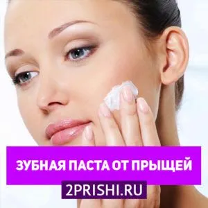 як лікувати прищі зубною пастою