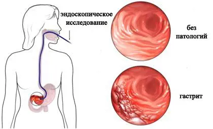 симптоми