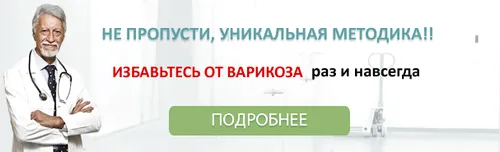 як лікувати варикоз АЛМАГ