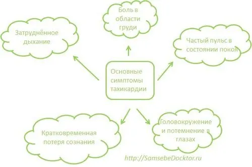 як лікувати напад тахікардії