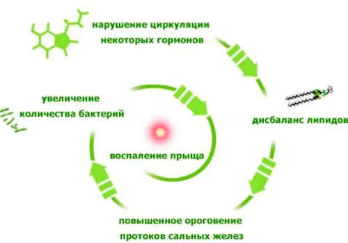 як лікувати прищі у вагітних