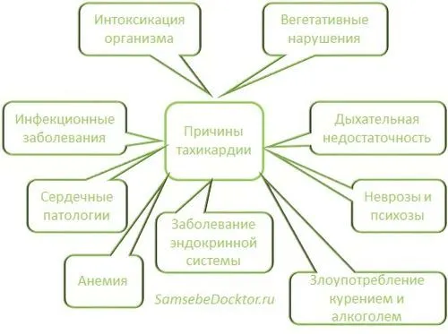 як лікувати напад тахікардії