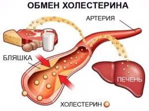як лікувати холецистит