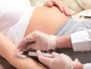 як лікувати застій жовчі печінки