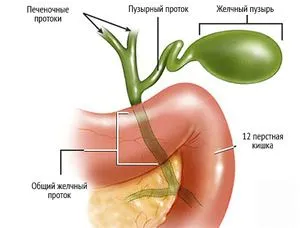 як лікувати застій жовчі печінки
