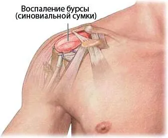 як лікувати суглоб руки