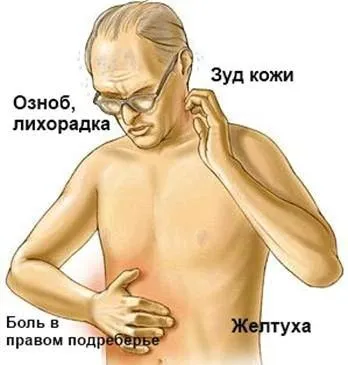 як лікувати механічну жовтяницю