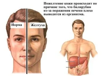 як лікувати печінку у дітей