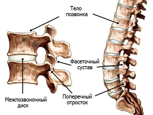 як лікувати фасеточний артроз