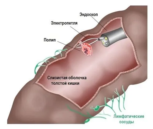 прямий