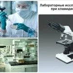 як лікувати трихомоніаз і хламідіоз
