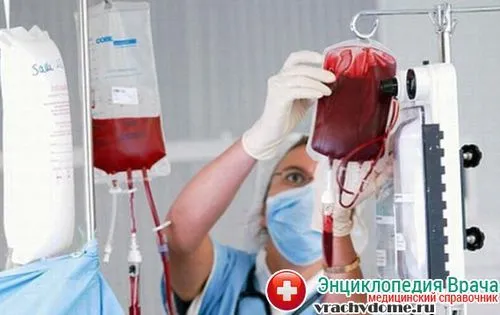 Симптоми і причини апластичної анемії у дітей і дорослих апластична анемія симптоми лікування
