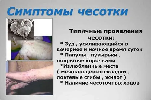 як лікувати коросту без ходів
