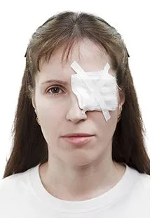 лікувати забій під оком