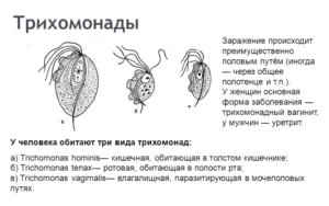 як лікувати кишкову трихомонаду