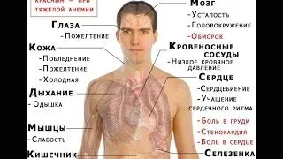 як лікувати нормохромнаяанемія