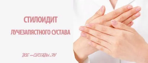 стілоідіт лучезапястного суглоба лікування народні засоби