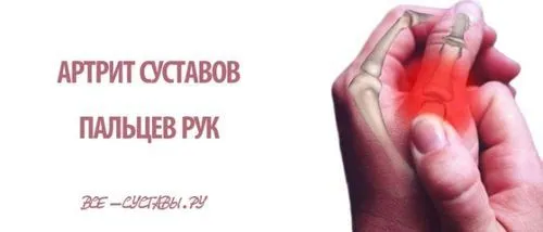 артрит суглобів пальців рук лікування симптоми народні засоби