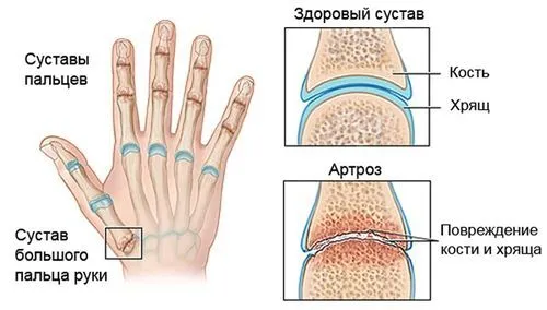 методи