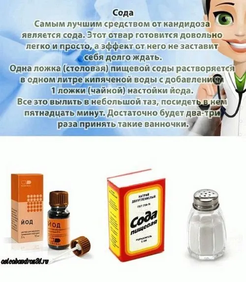 молочниця при вагітності